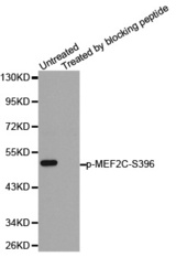 Western blot analysis of extracts from 24 hours starved 3T3 cells using Phospho-MEF2C-S396 antibody.