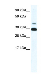 THRB antibody LS-B1005 Western blot of Fetal skeletal muscle lysate.