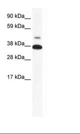 Fetal Skeletal Muscle Lysate
