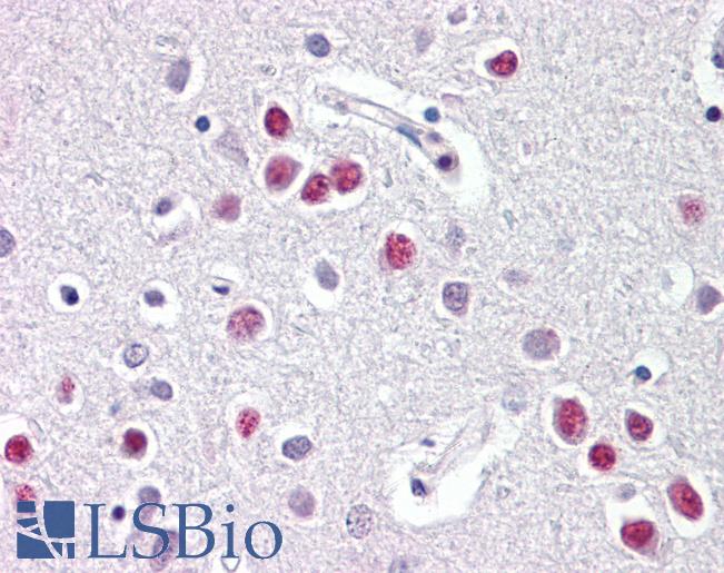 Anti-NR1D1 antibody IHC of human brain, cortex. Immunohistochemistry of formalin-fixed, paraffin-embedded tissue after heat-induced antigen retrieval. Antibody LS-B8100 dilution 5-10 ug/ml.