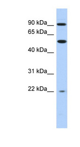 NR1D2 antibody LS-C109821 Western blot of THP-1 cell lysate.