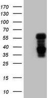 HEK293T cells were transfected with the pCMV6-ENTRY control (Left lane) or pCMV6-ENTRY NR1D2 (Right lane) cDNA for 48 hrs and lysed. Equivalent amounts of cell lysates (5 ug per lane) were separated by SDS-PAGE and immunoblotted with anti-NR1D2.