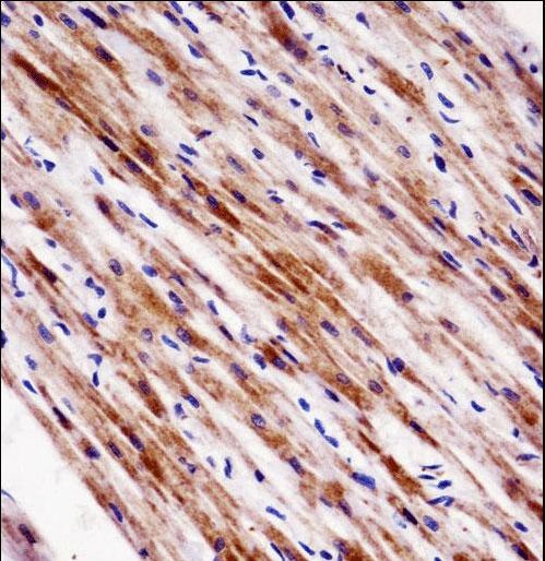 NR1D2 Antibody immunohistochemistry of formalin-fixed and paraffin-embedded human heart tissue followed by peroxidase-conjugated secondary antibody and DAB staining.
