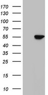 HEK293T cells were transfected with the pCMV6-ENTRY control (Left lane) or pCMV6-ENTRY NR1H3 (Right lane) cDNA for 48 hrs and lysed. Equivalent amounts of cell lysates (5 ug per lane) were separated by SDS-PAGE and immunoblotted with anti-NR1H3.