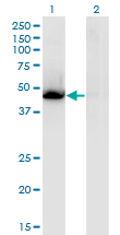 Western blot of NR1H3 expression in transfected 293T cell line by NR1H3 monoclonal antibody LS-C139252