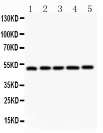 NR1H3 antibody Western blot. All lanes: Anti NR1H3 at 0.5 ug/ml. Lane 1: Rat Liver Tissue Lysate at 50 ug. Lane 2: Rat Lung Tissue Lysate at 50 ug. Lane 3: Rat Spleen Tissue Lysate at 50 ug. Lane 4: Rat Kidney Tissue Lysate at 50 ug. Lane 5: Human Placenta Tissue Lysate at 50 ug. Predicted band size: 51 kD. Observed band size: 51 kD.