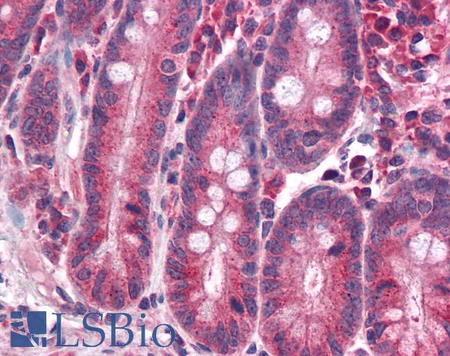 Anti-NR1H3 / LXR Alpha antibody IHC of human small intestine. Immunohistochemistry of formalin-fixed, paraffin-embedded tissue after heat-induced antigen retrieval. Antibody LS-B4626 concentration 5 ug/ml.