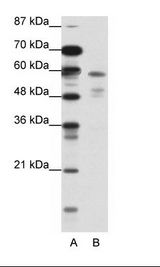A: Marker, B: Jurkat Cell Lysate