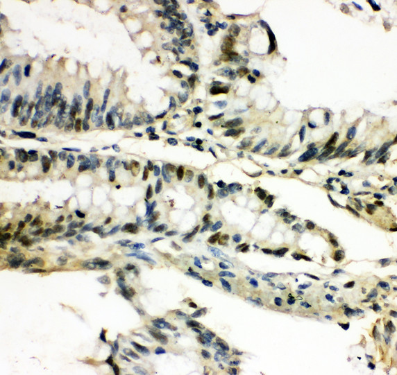 MEF2C antibody. IHC(P): Human Intestine Tissue.