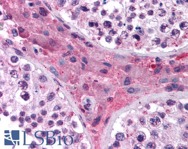 Anti-NR1H4 antibody IHC of human testis. Immunohistochemistry of formalin-fixed, paraffin-embedded tissue after heat-induced antigen retrieval. Antibody LS-B987 concentration 5 ug/ml.
