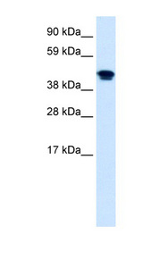 NR1H4 antibody LS-B987 Western blot of Fetal lung lysate.