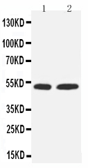 WB of MEF2C antibody. All lanes: Anti-MEF2C at 0.5ug/ml. Lane 1: Rat Testis Tissue Lysate at 40ug. Lane 2: COLO320 Whole Cell Lysate at 40ug. Predicted bind size: 51KD. Observed bind size: 51KD.