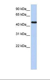Transfected 293T cell lysate. Antibody concentration: 1.0 ug/ml. Gel concentration: 12%.