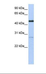 Transfected 293T cell lysate. Antibody concentration: 1.0 ug/ml. Gel concentration: 12%.