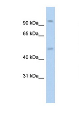 NR3C1 / Glucocorticoid Receptor antibody LS-C134924 Western blot of HepG2 Cell lysate. Antibody concentration 1 ug/ml.