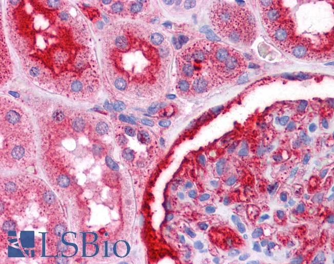 Anti-NR4A2 / NURR1 antibody IHC of human kidney. Immunohistochemistry of formalin-fixed, paraffin-embedded tissue after heat-induced antigen retrieval. Antibody LS-B4582 concentration 5 ug/ml.
