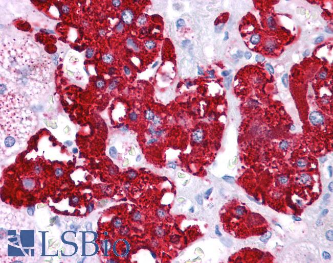 Anti-NR4A2 / NURR1 antibody IHC of human adrenal. Immunohistochemistry of formalin-fixed, paraffin-embedded tissue after heat-induced antigen retrieval. Antibody LS-B4582 concentration 5 ug/ml.