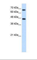 Jurkat cell lysate. Antibody concentration: 0.25 ug/ml. Gel concentration: 12%.