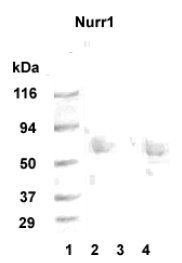 Western blot detection of Nurr1 in 20 ug of human hippocampus tissue lysate (lanes 2 and 4) with Nurr1 polyclonal at 1:1000 dilution followed by AP-conjugated secondary at 1:5000 dilution. MW marker lane 1. Peptide absorption control lane 3.