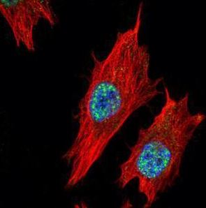 Anti-Nurr1 antibody used in ICC/IF.