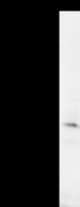 Detection of human NR4A2 by Western blot. Samples: Whole cell lysate (25 ug) from HeLa cells. Predicted molecular weight: 66 kDa