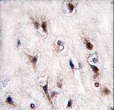 Formalin-fixed and paraffin-embedded human brain tissue reacted with NURR1 (NR4A2) antibody , which was peroxidase-conjugated to the secondary antibody, followed by DAB staining. This data demonstrates the use of this antibody for immunohistochemistry; clinical relevance has not been evaluated.