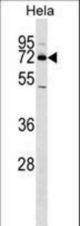 NR4A2 Antibody western blot of HeLa cell line lysates (35 ug/lane). The NR4A2 antibody detected the NR4A2 protein (arrow).