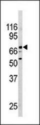 Western blot of anti-NURR1(NR4A2) antibody in mouse brain tissue lysate. NURR1(NR4A2) (arrow) was detected using the purified antibody.