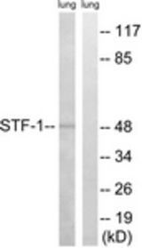 Western blot of extracts from rat lung, using STF-1 (Ab-203) Antibody. The lane on the right is treated with the synthesized peptide.