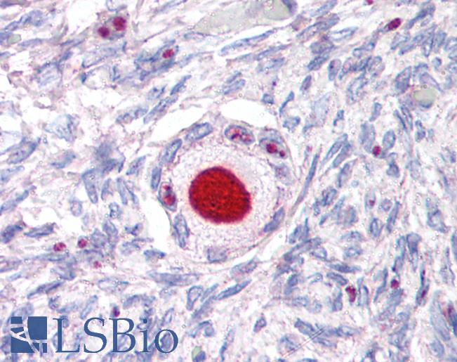 Anti-NR5A1 antibody LS-A5534 IHC of human ovary. Immunohistochemistry of formalin-fixed, paraffin-embedded tissue after heat-induced antigen retrieval.