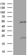 HEK293T cells were transfected with the pCMV6-ENTRY control (Left lane) or pCMV6-ENTRY NR5A1 (Right lane) cDNA for 48 hrs and lysed. Equivalent amounts of cell lysates (5 ug per lane) were separated by SDS-PAGE and immunoblotted with anti-NR5A1.
