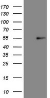 HEK293T cells were transfected with the pCMV6-ENTRY control (Left lane) or pCMV6-ENTRY NR5A1 (Right lane) cDNA for 48 hrs and lysed. Equivalent amounts of cell lysates (5 ug per lane) were separated by SDS-PAGE and immunoblotted with anti-NR5A1.