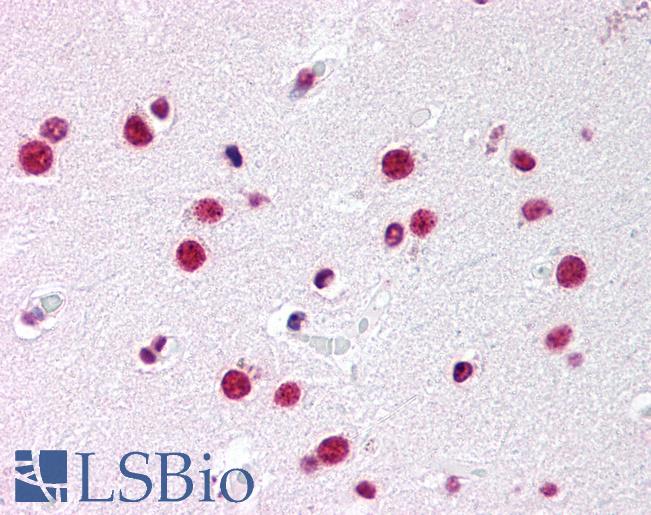 Anti-NR5A1 antibody LS-A5377 IHC of human brain, caudate. Immunohistochemistry of formalin-fixed, paraffin-embedded tissue after heat-induced antigen retrieval.