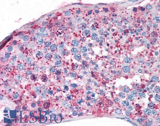 Anti-NR5A1 antibody LS-A5338 IHC of human testis. Immunohistochemistry of formalin-fixed, paraffin-embedded tissue after heat-induced antigen retrieval.
