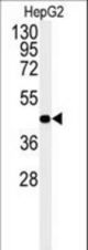 Western blot of NR5A1 Antibody in HepG2 cell line lysates (35 ug/lane). NR5A1 (arrow) was detected using the purified antibody.