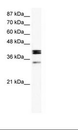 Daudi Cell Lysate