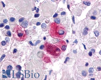 Anti-NR5A1 antibody LS-A2479 IHC of human brain, pituitary. Immunohistochemistry of formalin-fixed, paraffin-embedded tissue after heat-induced antigen retrieval.