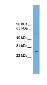NR6A1 / GCNF antibody LS-C116308 Western blot of THP-1 cell lysate.
