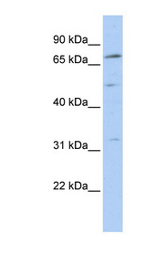 NR6A1 / GCNF antibody LS-C109684 Western blot of MCF7 cell lysate.