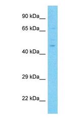 Western blot of NR6A1 Antibody with human Lymph Node Tumor lysate.