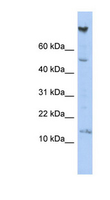 NRARP antibody LS-C111823 Western blot of HepG2 cell lysate.