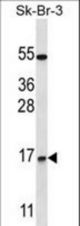 NRARP Antibody western blot of SK-BR-3 cell line lysates (35 ug/lane). The NRARP antibody detected the NRARP protein (arrow).