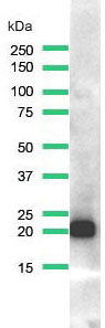 Western Blot analysis of SK-MEL-2 cell lysate with N-Ras (Q61R) antibody