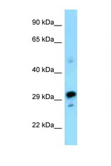 NRBF2 antibody LS-C146200 Western blot of Mouse Pancreas lysate. Antibody concentration 1 ug/ml.
