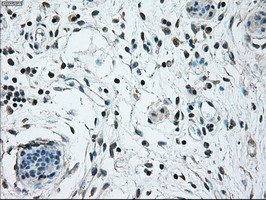 IHC of paraffin-embedded breast tissue using anti-NRBP1 mouse monoclonal antibody. (Dilution 1:50).