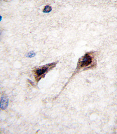 Formalin-fixed and paraffin-embedded human brain tissue reacted with MEF2C Antibody (S387) , which was peroxidase-conjugated to the secondary antibody, followed by DAB staining. This data demonstrates the use of this antibody for immunohistochemistry; clinical relevance has not been evaluated.