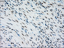 IHC of paraffin-embedded endometrium tissue using anti-NRBP1 mouse monoclonal antibody. (Dilution 1:50).