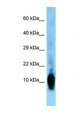 NRGN / Neurogranin antibody LS-C146394 Western blot of Rat Brain lysate. Antibody concentration 1 ug/ml.