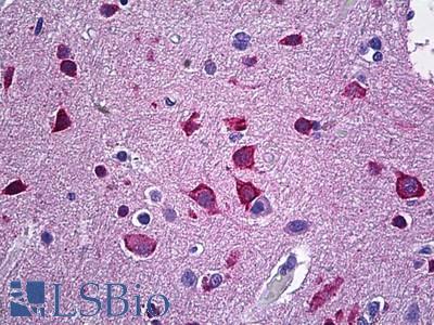 Anti-NRGN / Neurogranin antibody IHC of human brain, cortex. Immunohistochemistry of formalin-fixed, paraffin-embedded tissue after heat-induced antigen retrieval. Antibody LS-B5919 concentration 3.75 ug/ml.