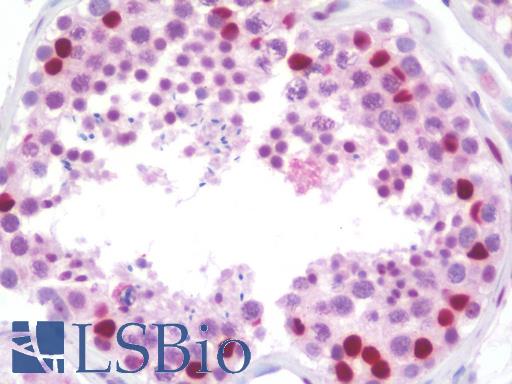 Human Testis: Formalin-Fixed Paraffin-Embedded (FFPE)